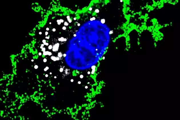 Microspoe picture of foam cell